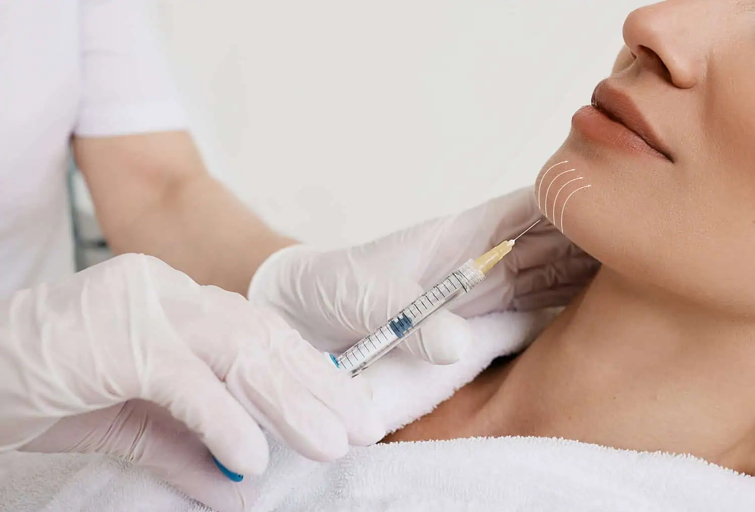 Facial Lipolysis Treatment | Limitless Aesthetics & Wellness | Scottsdale, AZ