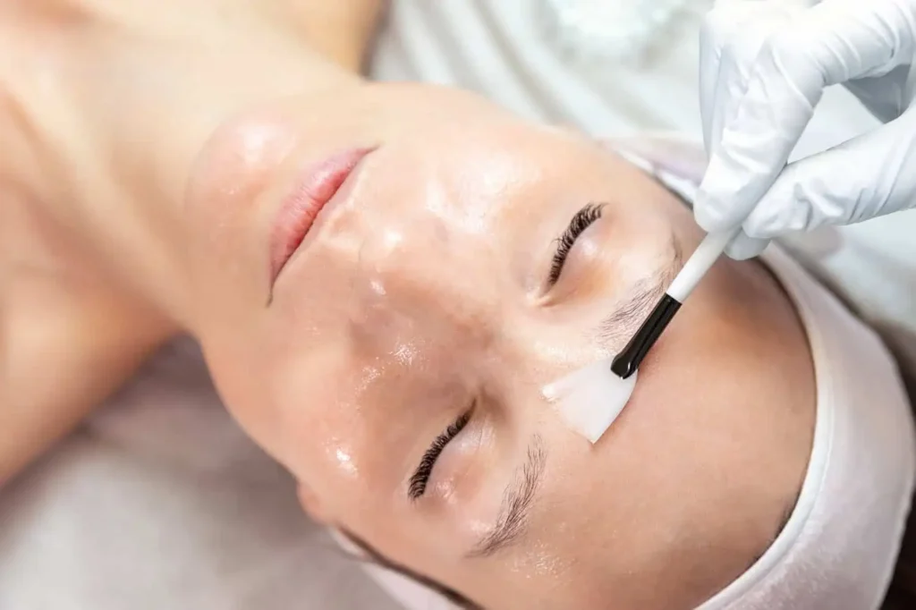 Medical-Grade Chemical Peels Treatment | Limitless Aesthetics & Wellness | Scottsdale, AZ