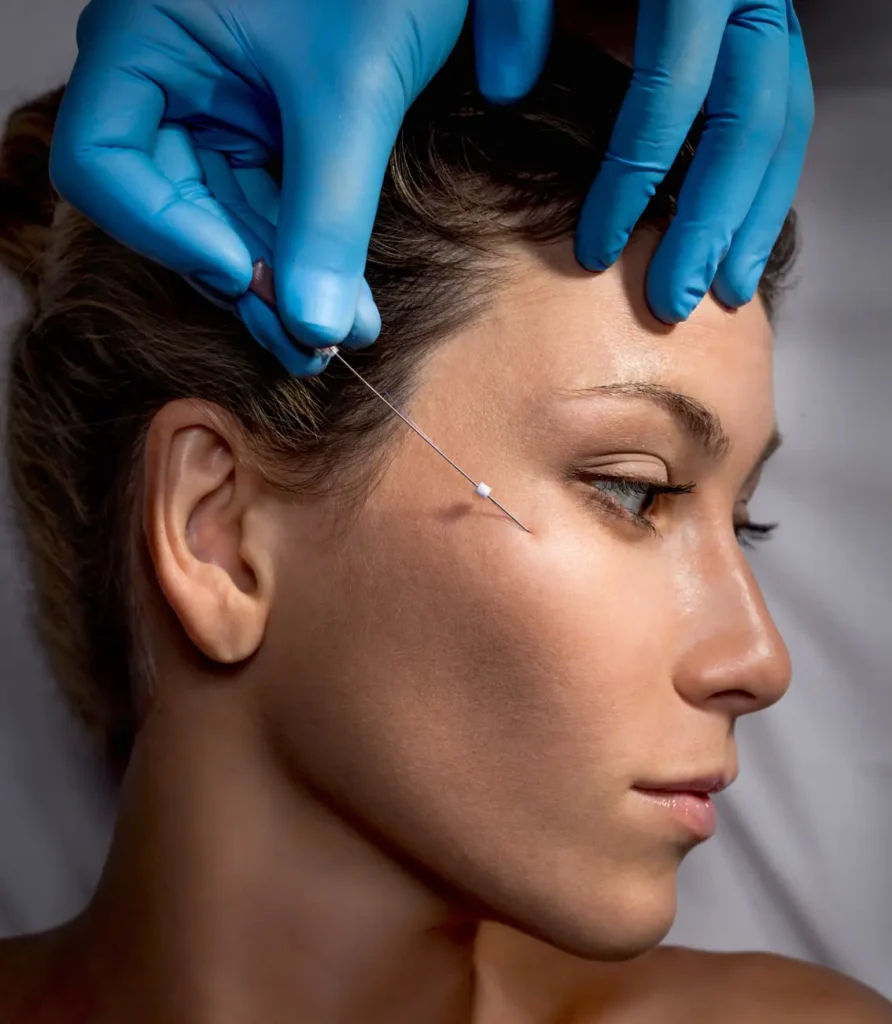 Dermal Fillers | Limitless Aesthetics & Wellness | Scottsdale, AZ